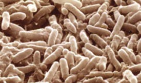 6970d45697f895df7a2e61ec Fc0712fd Desulfovibrio