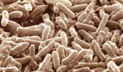 6970d45697f895df7a2e61ec Fc0712fd Desulfovibrio 6970d45697f895df7a2e61ec Fc0712fd Desulfovibrio