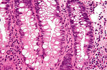 Nephron/Wikipedia Commons