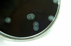 Campylobacter bacteria Campylobacter bacteria