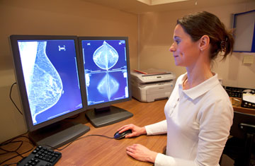 breast cancer Frans Rombout/iStockphoto/Thinkstock