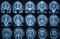 Bunyos/iStockphoto/ThinkStock Bunyos/iStockphoto/ThinkStock