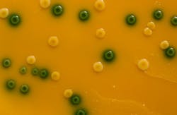 villorejo/iStockphoto/Thinkstock villorejo/iStockphoto/Thinkstock