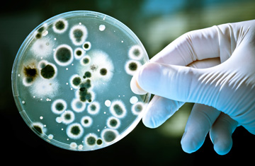 Petri dish with bacteria