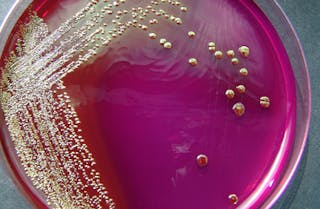 E. coli in petri dish