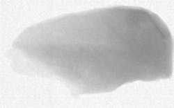 A high energy X-ray. A high energy X-ray.