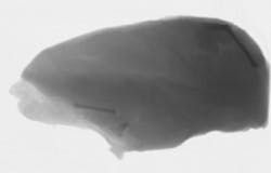 A low energy X-ray. A low energy X-ray.