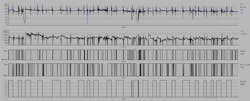 Data trends can mask important changes in performance as a process transitions between multiple operating states. The trend above shows the process variable and controller output of a controller as it regulates performance across a total of eight different condition combinations. Data trends can mask important changes in performance as a process transitions between multiple operating states. The trend above shows the process variable and controller output of a controller as it regulates performance across a total of eight different condition combinations.