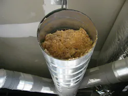 Plugged duct Plugged duct